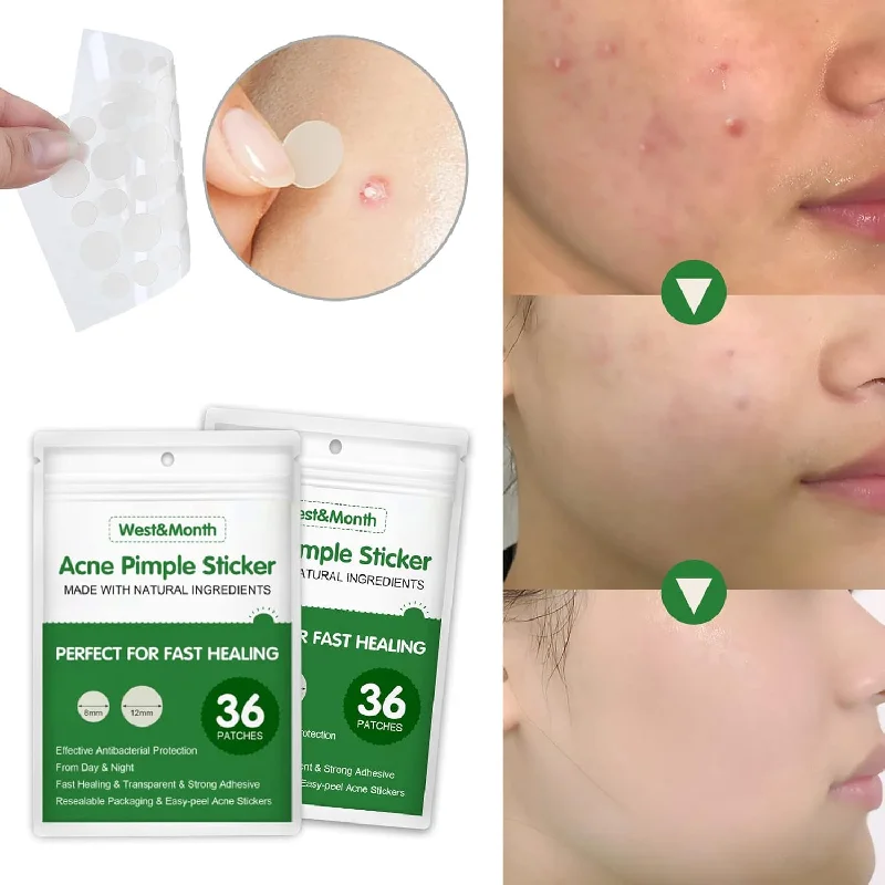 (NET) Ketsicart Transparent Invisible Acne Remover